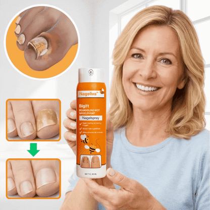Nageliva™ Svampdödande Spray | Hjälper till att ta itu med upp till 99 % av nagelsvamp på bara 3 dagar!