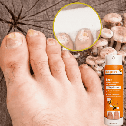 Nageliva™ Svampdödande Spray | Hjälper till att ta itu med upp till 99 % av nagelsvamp på bara 3 dagar!