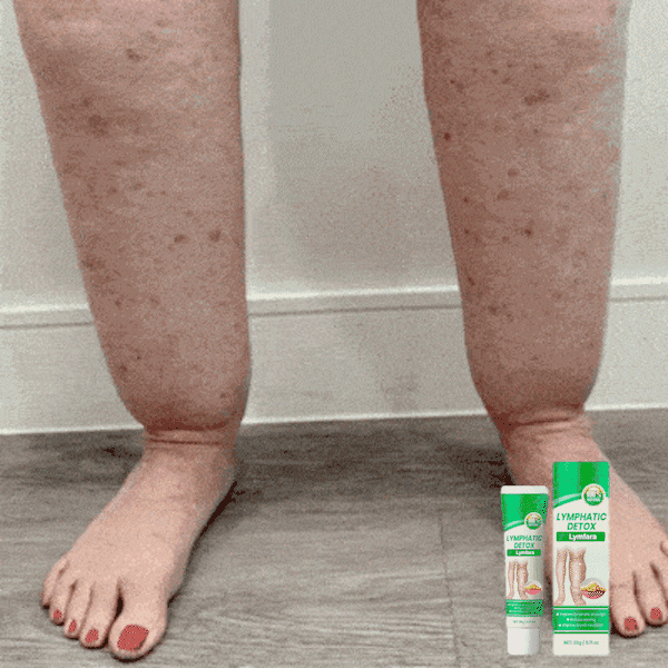 Lymviva™  | Minskar svullnad och vätskeretention märkbart inom 24 timmar