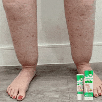 Lymviva™  | Minskar svullnad och vätskeretention märkbart inom 24 timmar